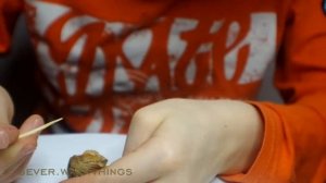 ВСКРЫТИЕ ООТЕКИ БОГОМОЛА