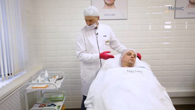 Коррекция рубцов постакне. смотреть онлайн