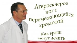 Атеросклероз ног с перемежающейся хромотой.Как врачи могут лечить.Видеобеседа для ВСЕХ и для врачей.