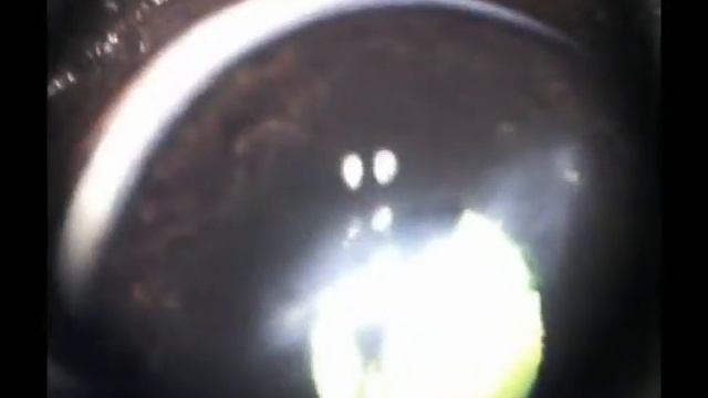 Травма глаза у собаки. Ши-тцу травма глаза когтем кошки. смотреть онлайн