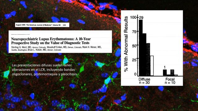 Lupus, ictus, y otras cosas смотреть онлайн