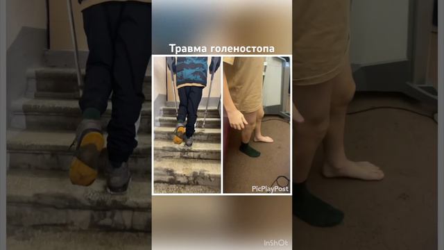 Футболист 13 лет получил сильнейшее растяжение - отек и воспаление голеностопе .Не мог даже ходить