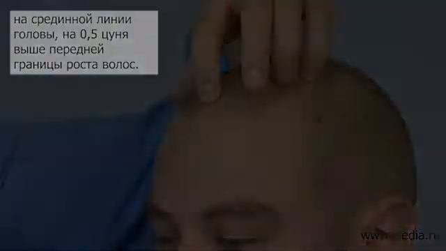 Психастения