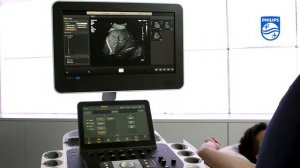 Сдвиговая эластография печени на УЗИ аппаратах Epiq Philips | uzimir.ru