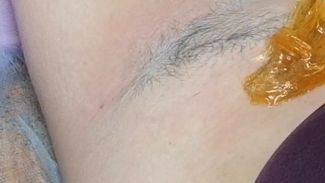 Шугаринг сахарной пастой. Как удалять волосы подмышками. Обучающий курс.