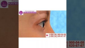 Пластический хирург Якубов Шерзод Ильхамович