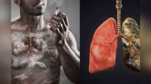 ПРОФИЛАКТИКА ВРЕДНЫХ ПРИВЫЧЕК