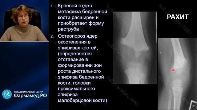 синдромная диагностика остеология