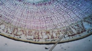 анатомия стебля древесных растений