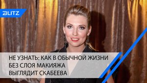 Не узнать: как в обычной жизни без слоя макияжа выглядит Скабеева