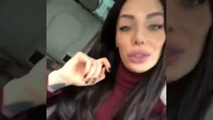 Отзыв после операции по ринопластике.