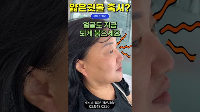 줄기세포 : 귓볼주름, 얇아진귓볼 붉은얼굴👂귀 이상없는 메니에르, 두통 눈통증 머리 꽉 차는 뇌압 찰 때  I #루이빈치과 류지헌 원장