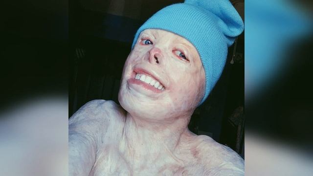 He shouldn't have survived, but... смотреть онлайн