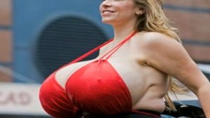 Chelsea Charms | Maiores Seios Artificiais do Mundo | Recordista Mundial