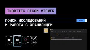 Поиск исследований и работа с хранилищем в Инобитек DICOM-Просмотрщике
