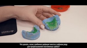 Что делать, если у ребенка дефицит места в зубном ряду для прорезывания постоянных зубов?