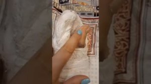 Перелом голеностопа от а до я