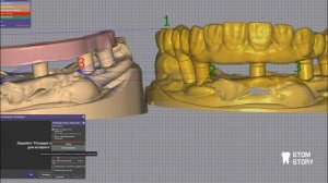 Ответная часть из диоксида циркония на титановую балку