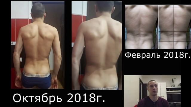 Миофасциальный синдром.  История Эдуарда Лутфуллина