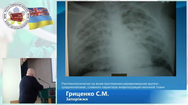 Синдром Мендельсона в акушерстві. С.М. Гриценко смотреть онлайн