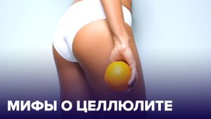 Как ИЗБАВИТЬСЯ от ЦЕЛЛЮЛИТА: методы, уход, питание