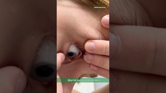 Как правильно снимать ночные линзы смотреть онлайн