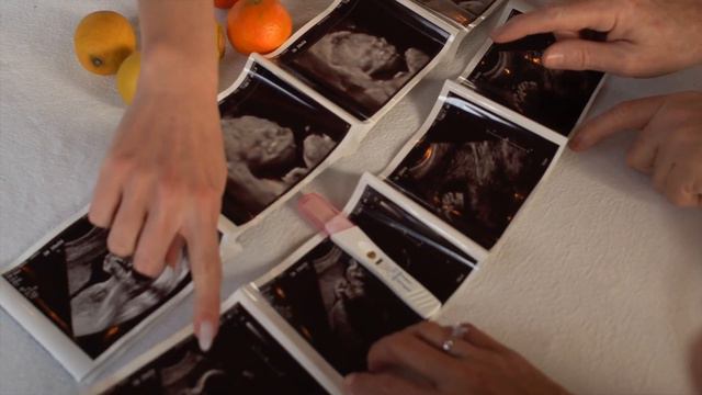 ОТЛОЖЕННОЕ МАТЕРИНСТВО  Что значит отложенное материнство и как все происходит