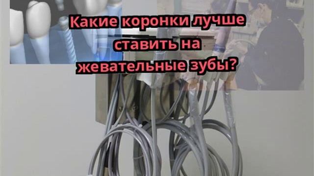 Какие коронки лучше ставить на жевательные зубы? смотреть онлайн