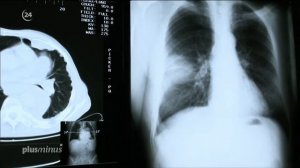 Германия: "асбестовые" дома - угроза жизни