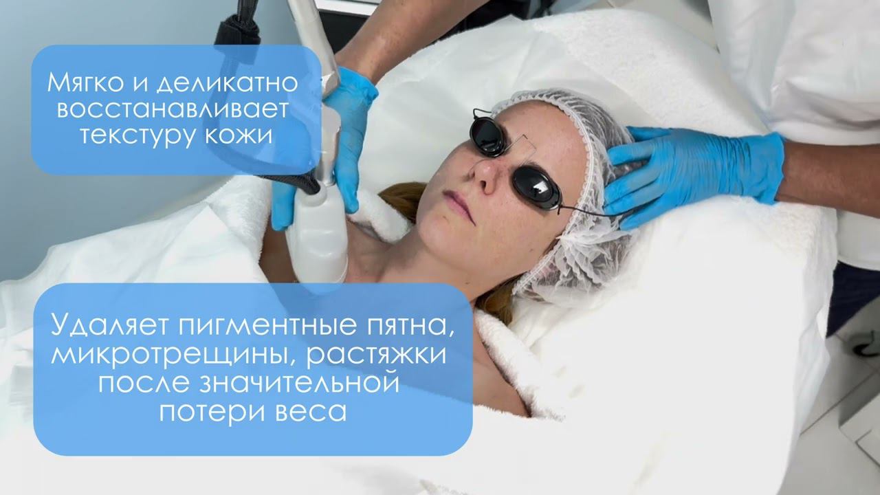 КОСМЕТОЛОГИЯ. Инновационные процедуры омоложения кожи в Клинике Н.Доценко #лазер #косметолог #short