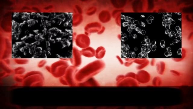 КВАНТОВЫЙ ГИПЕРСВЕТ BIOPTRON® (гиперполяризованный свет)