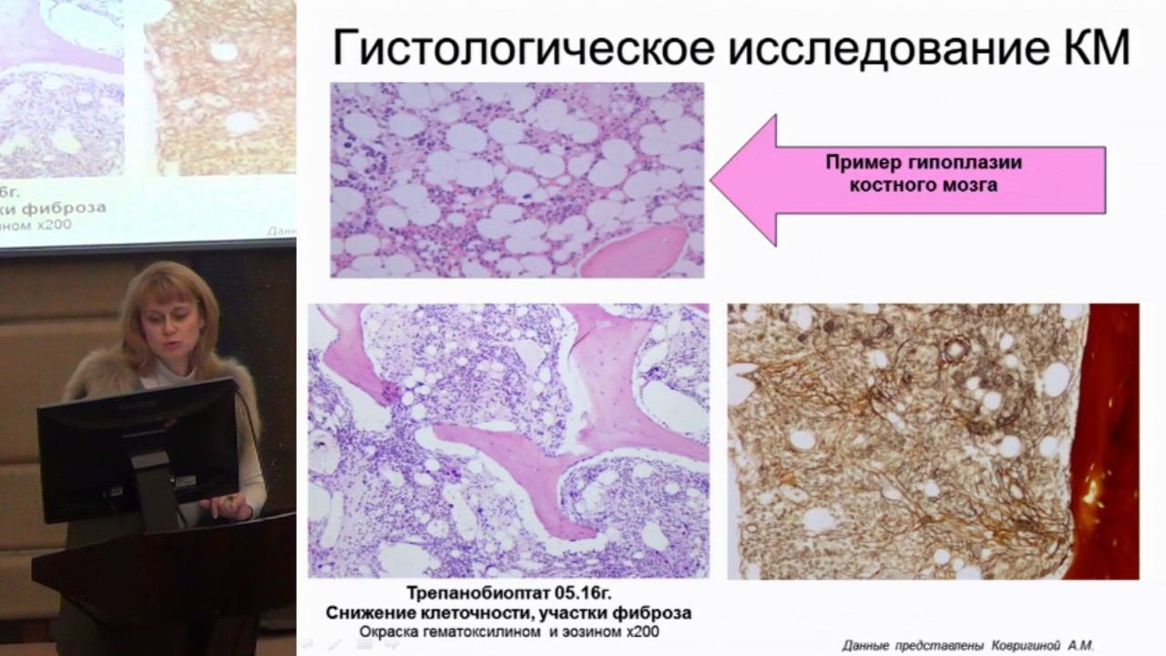 Современная гематология. Проблемы и решения. (часть 6)