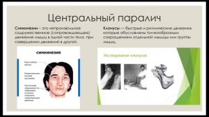 Дифференциальная диагностика центрального и периферического паралича