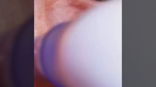 Вакумный очиститель пор