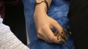 Как убрать поскорее папулы после биоревитализации?