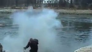 Оторвало кисть руки