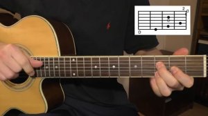 Канатчикова дача. Аккорды Высоцкого