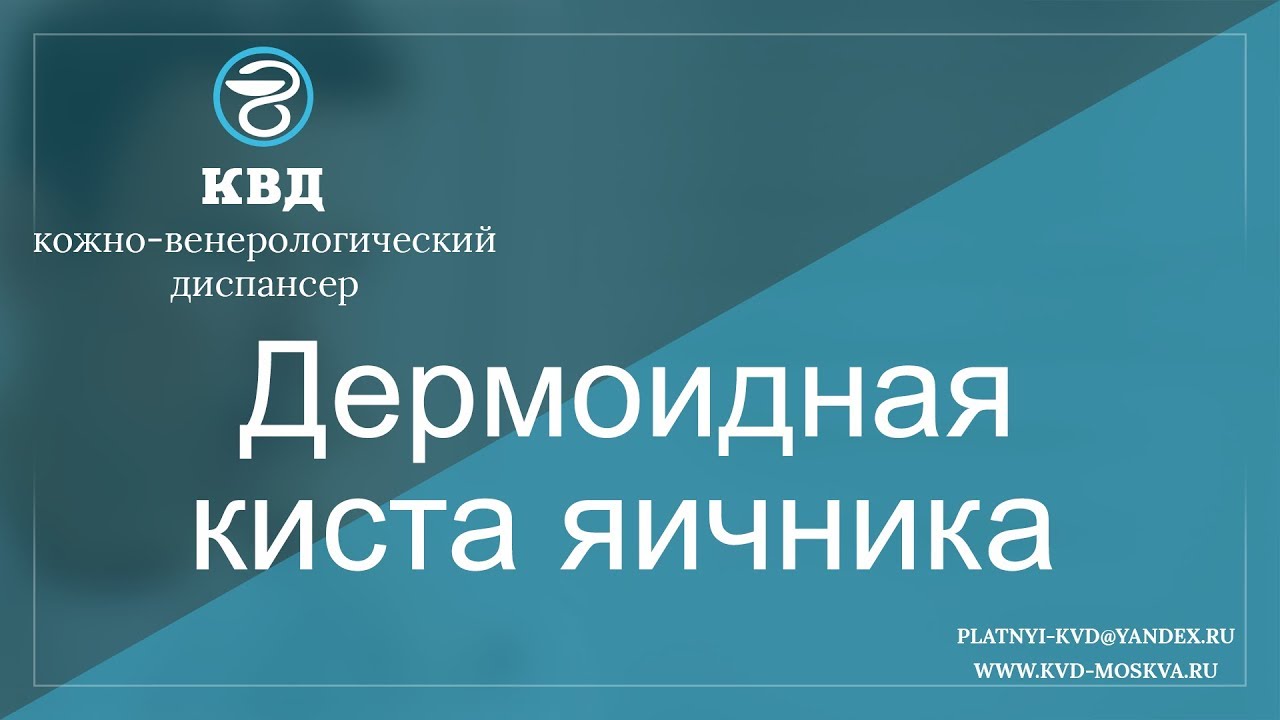 734  Дермоидная киста яичника