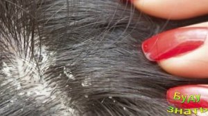 СЕБОРЕЯ - сухая и жирная - неприятная "вещь"