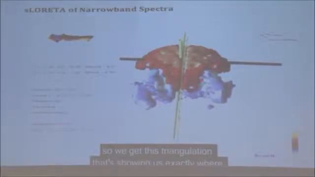 Исследование метода ACCESS BARS с помощью ЭЭГ (электроэнцефалограммы головного мозга) смотреть онлайн