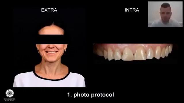 Дентальная фотография. Фотопротокол. Часть 1