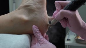 Педикюр/ Обработка стопы дисками / Покрытие ногтей гель лаком