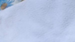 20201108 140542  САМ СЕБЕ ВЫРВАЛ КОРЕННОЙ ЗУБ