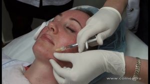 Как убрать шрамы на лице