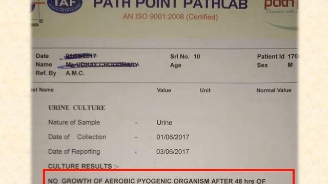 Urine Culture Test in Hindi | How to Read Urine Culture Test Report ? смотреть онлайн