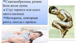 Геморрагический васкулит