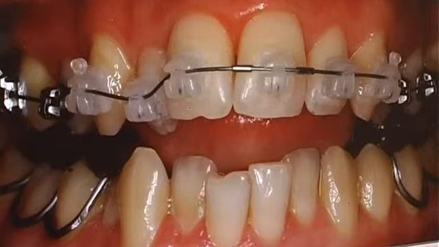 0110 Азбука 6 смотреть онлайн