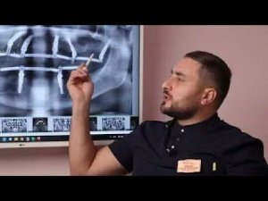 Мурадян Сергей Робертович – стоматолог-ортопед Центра имплантации Доктора Федорова