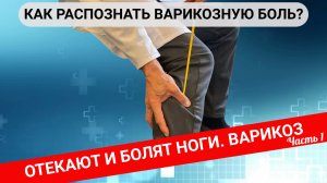 ОТЁКИ И БОЛЬ В НОГАХ. Как распознать варикозную боль?  (Часть 1)