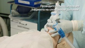 Интубация трахеи